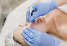 michalina-saywowclinic - medycyna estetyczna śląskie.jpg